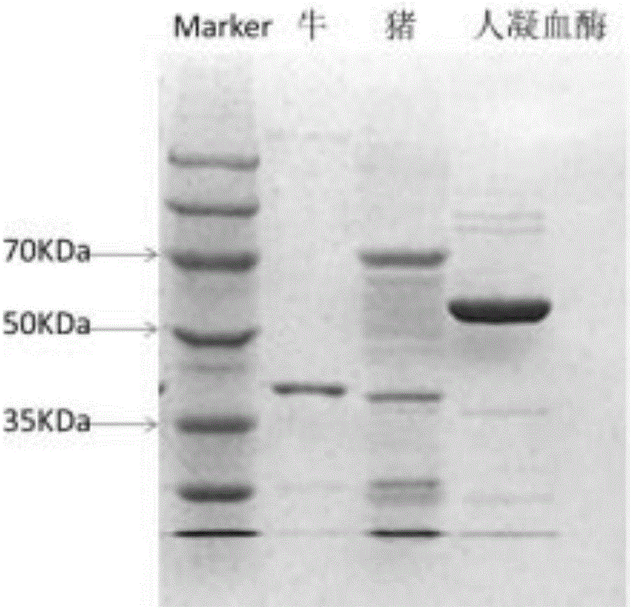 Thrombin time detection reagent