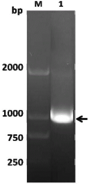 Novel positive antigen of echinococcus granulosus and application of antigen