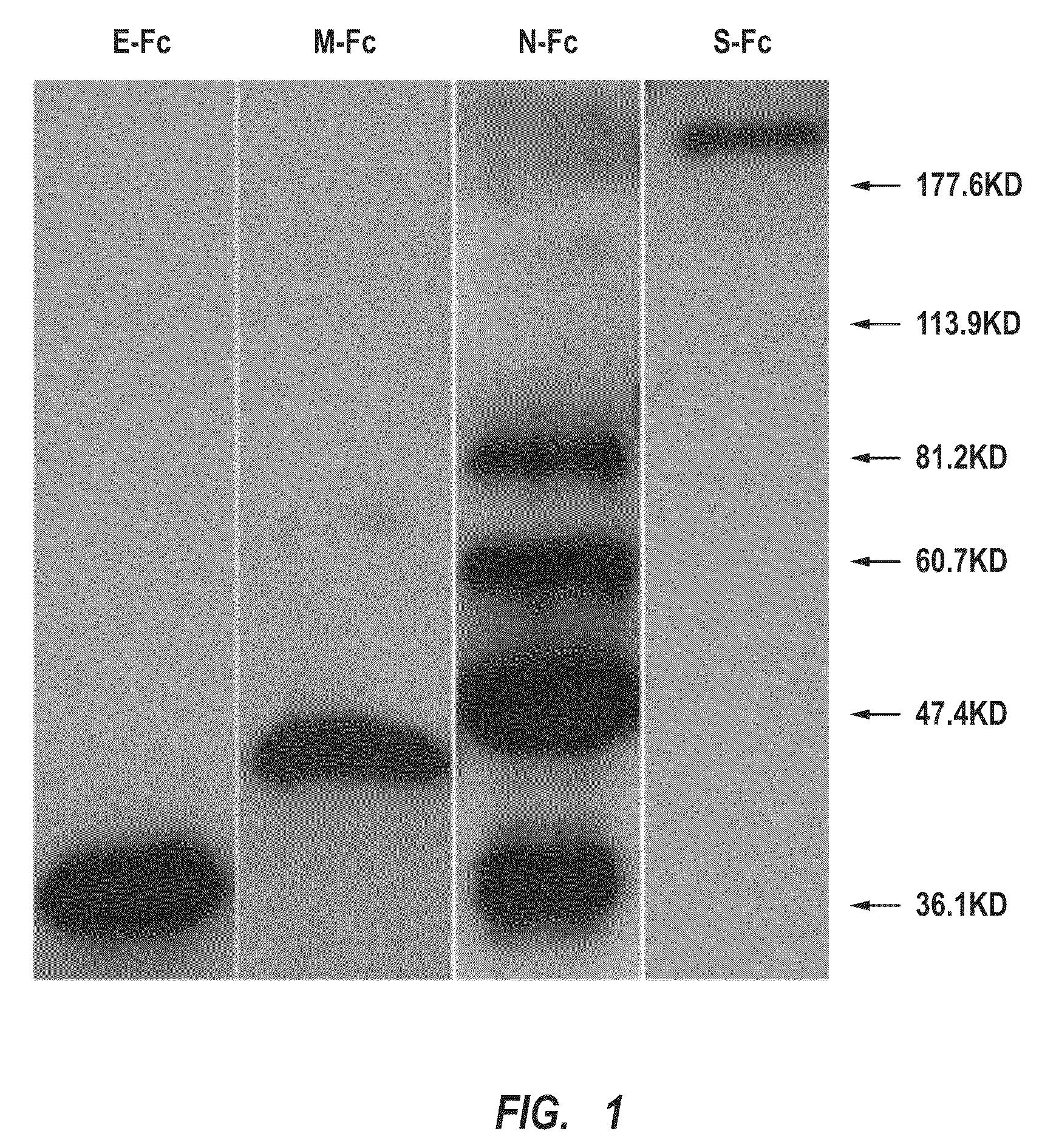 Fusion proteins of recombinant sars coronavirus structural proteins, their production and uses