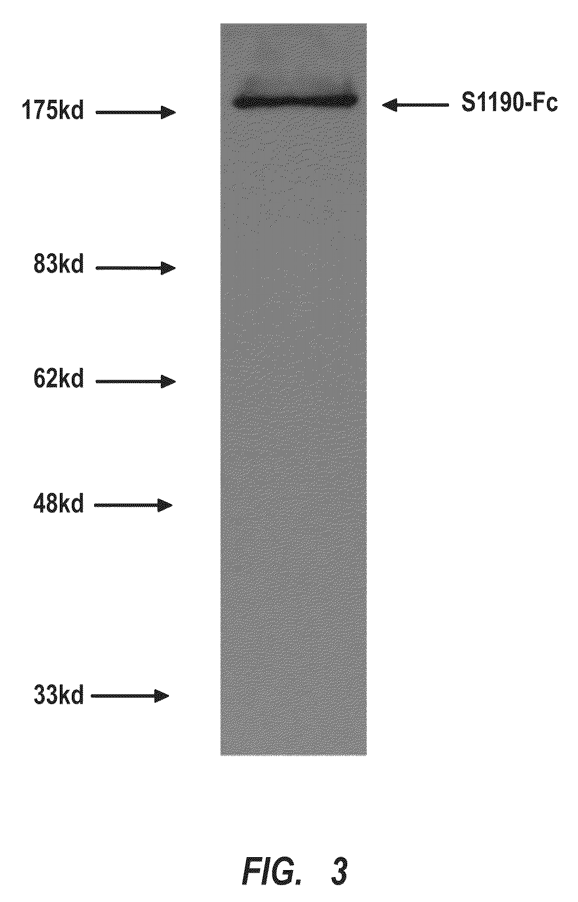 Fusion proteins of recombinant sars coronavirus structural proteins, their production and uses