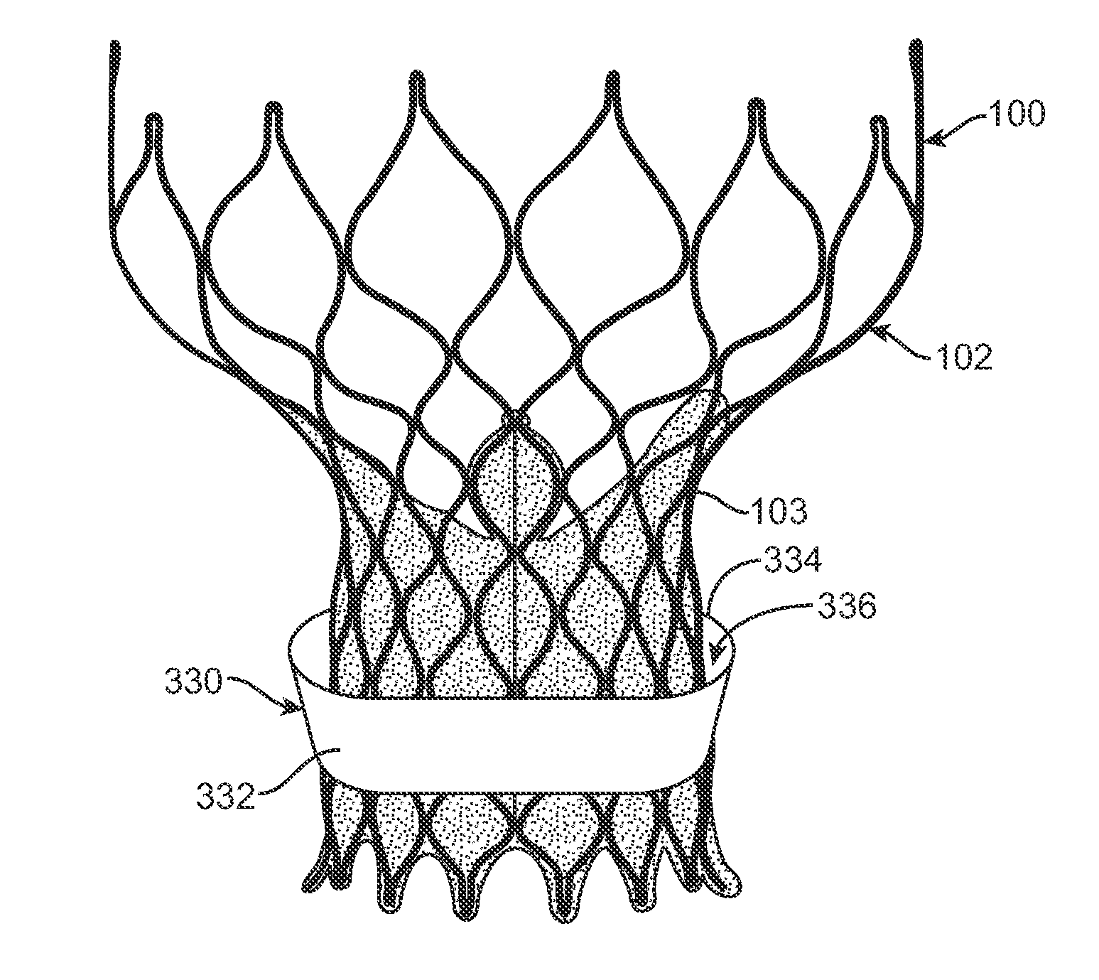 Anti-paravalvular leakage components for a transcatheter valve prosthesis