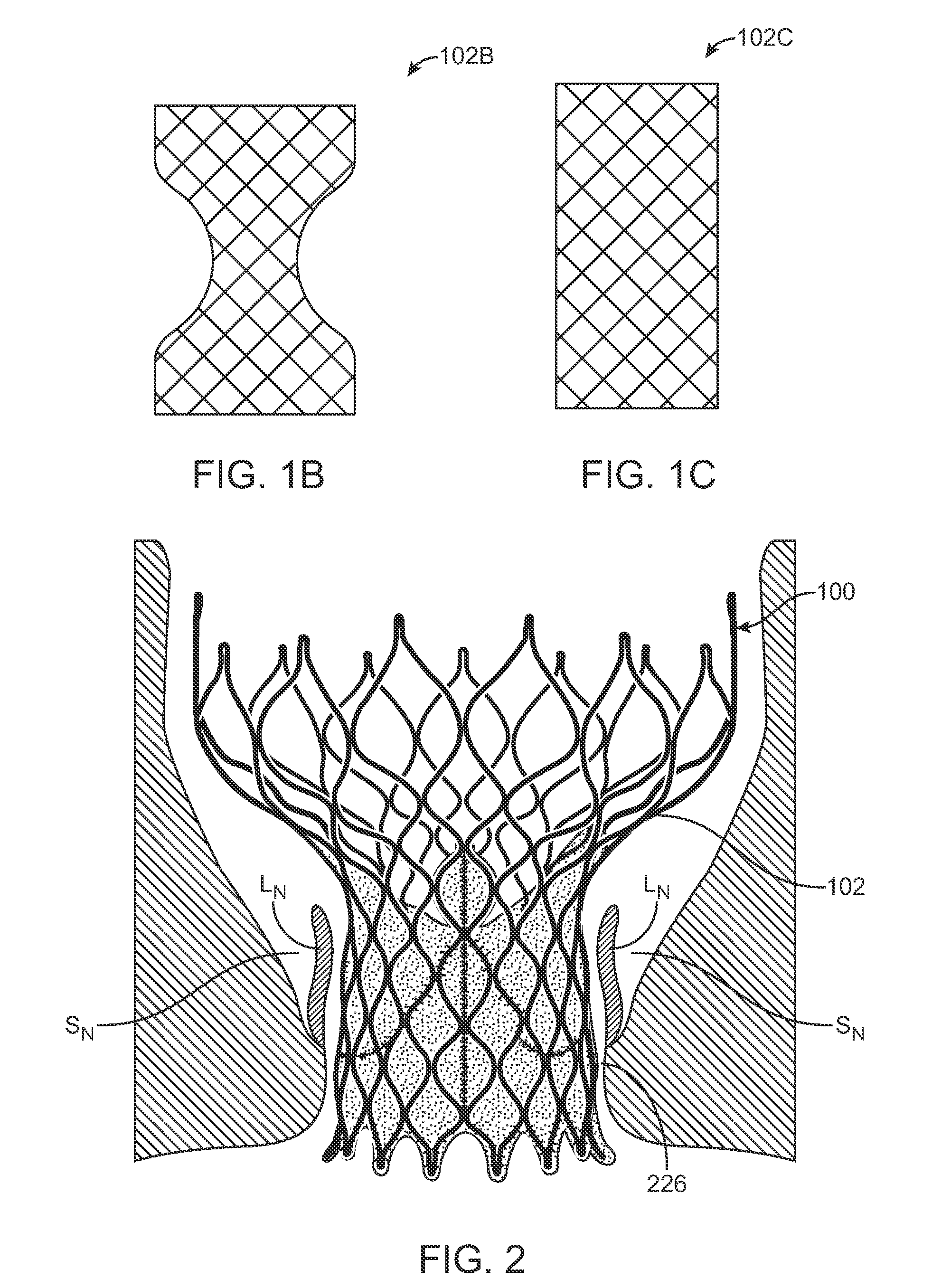 Anti-paravalvular leakage components for a transcatheter valve prosthesis