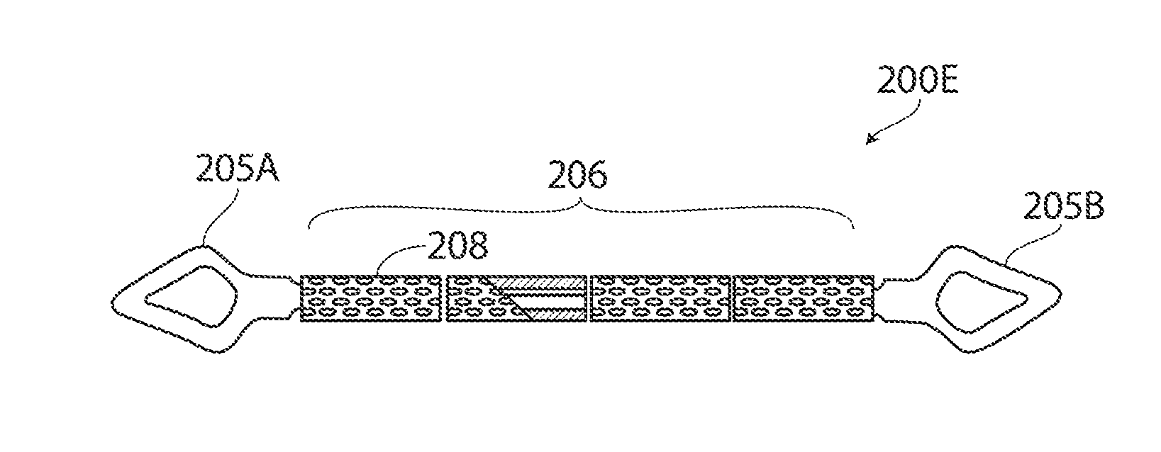 Systems and methods for treatment of sleep apnea