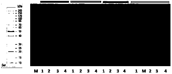 Preparation method of human-derived copper-zinc superoxide dismutase