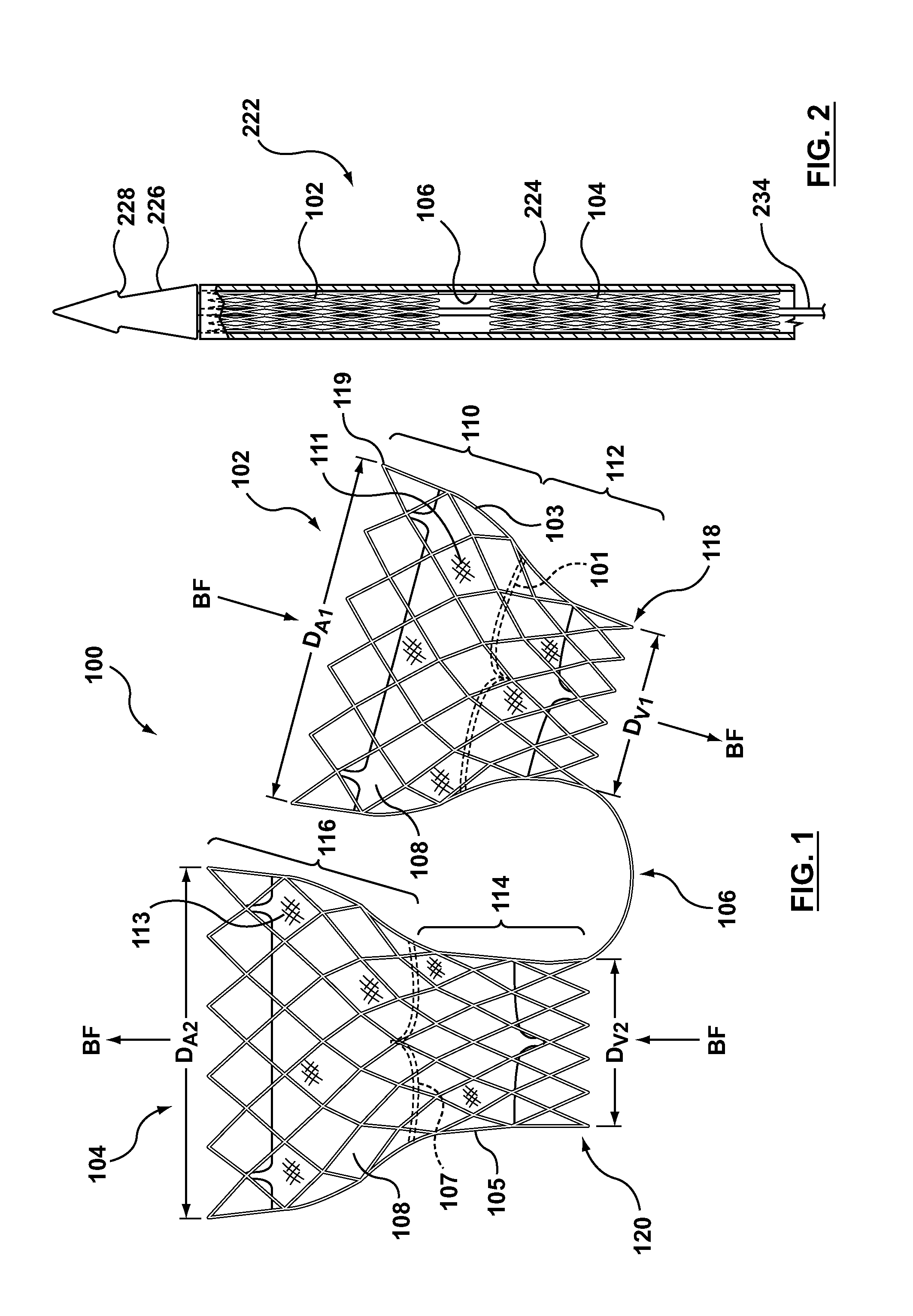 Dual valve prosthesis for transcatheter valve implantation