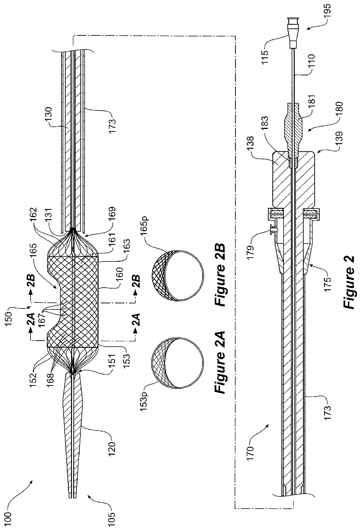 Medical device for temporary deployment into a bodily lumen