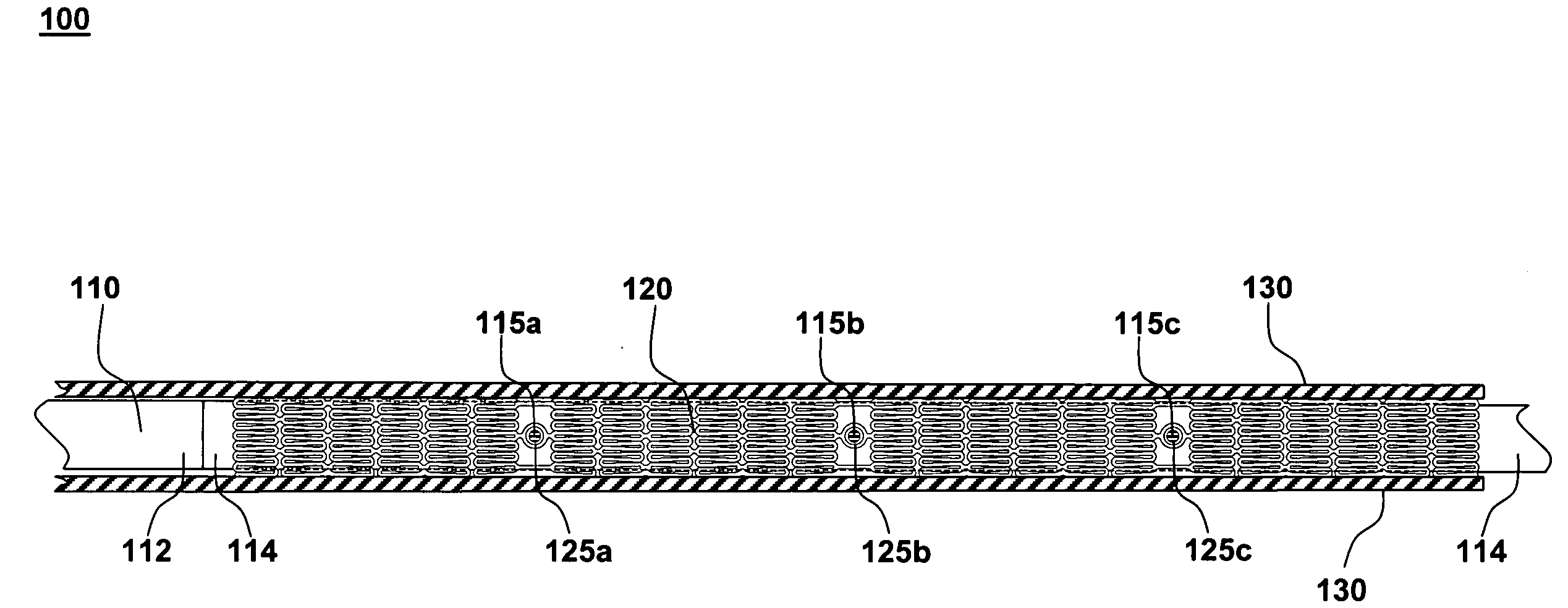 Force distributing system for delivering a self-expanding stent