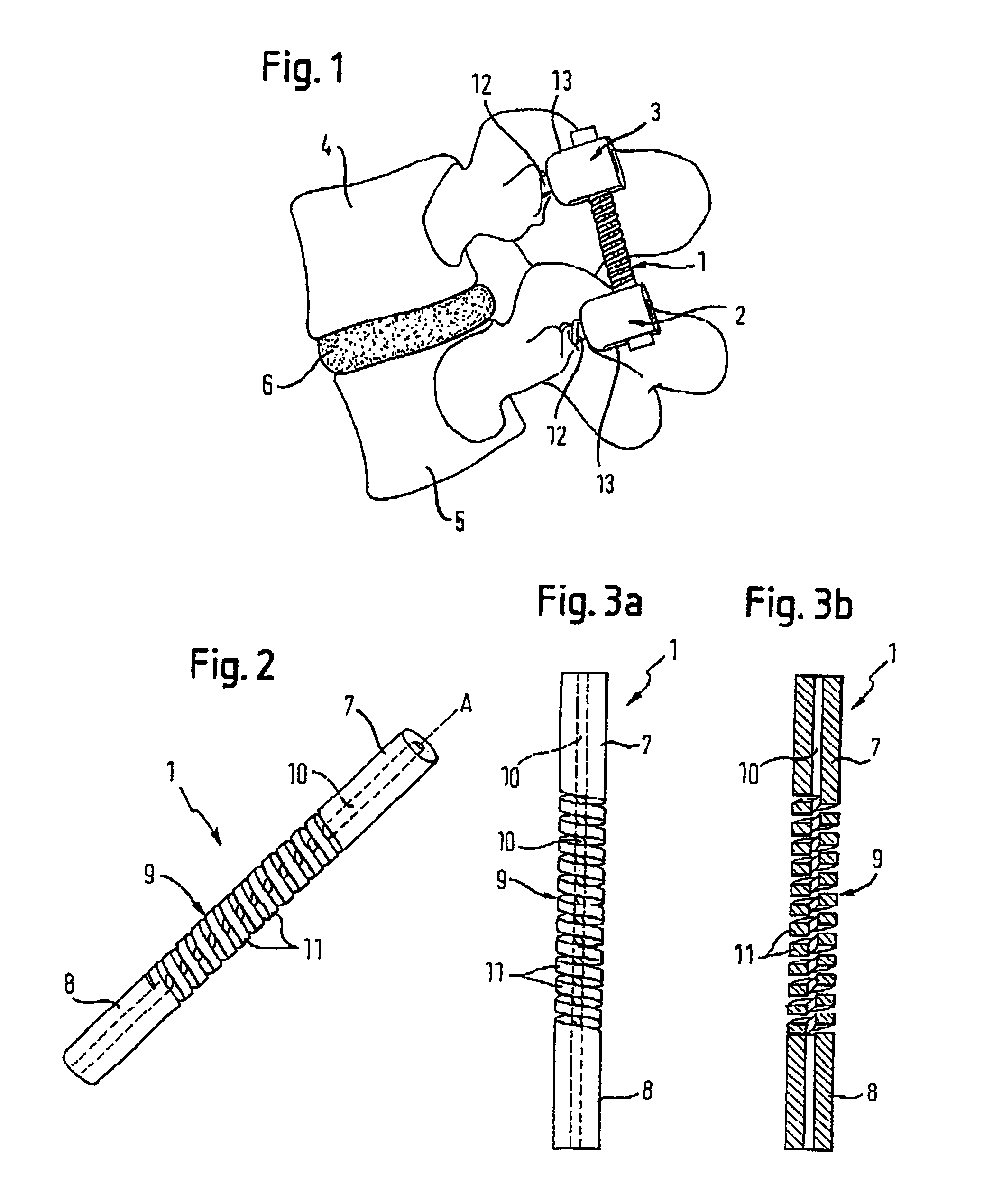 Rod-shaped implant element with flexible section