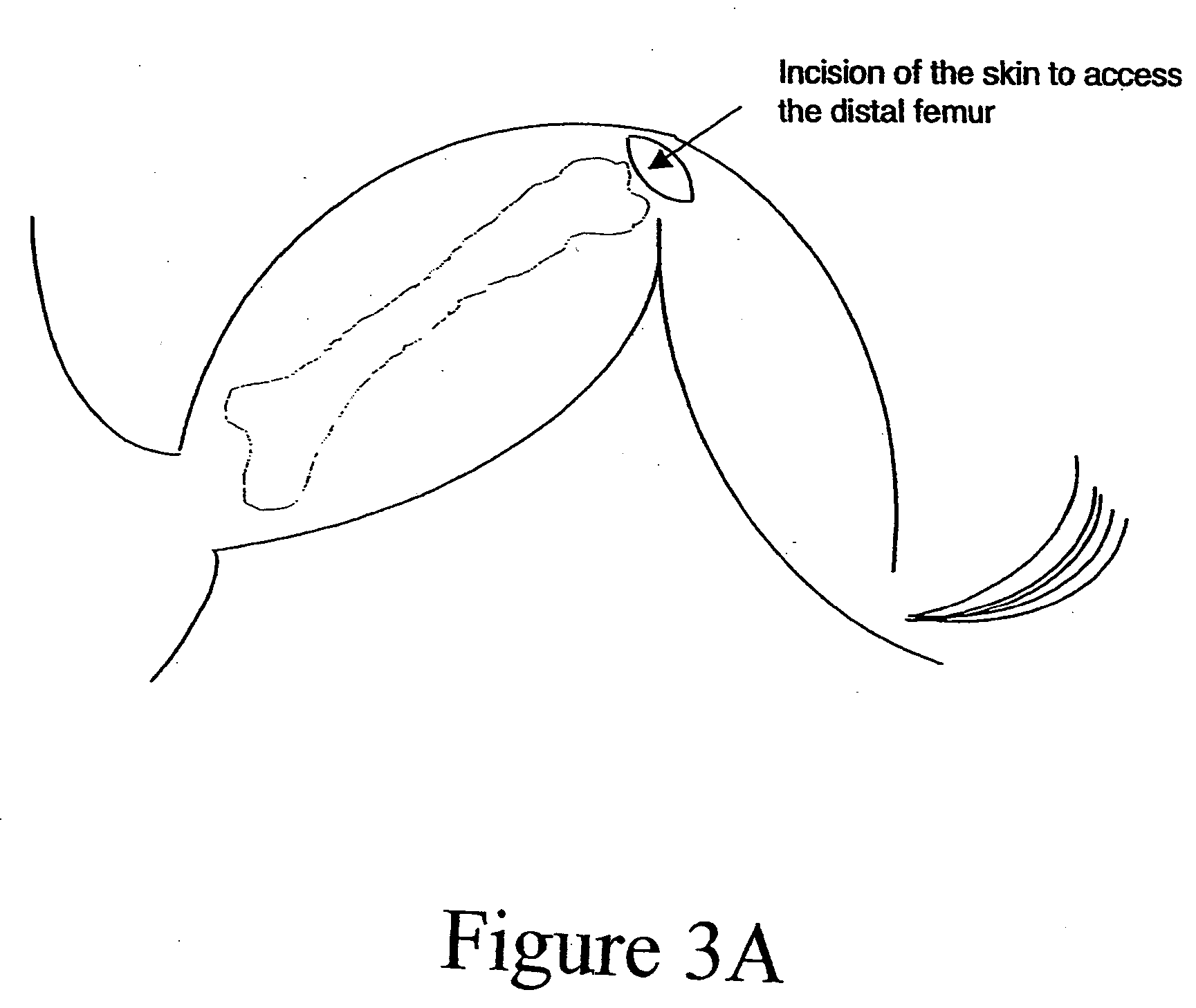 Method for fostering bone formation and preservation