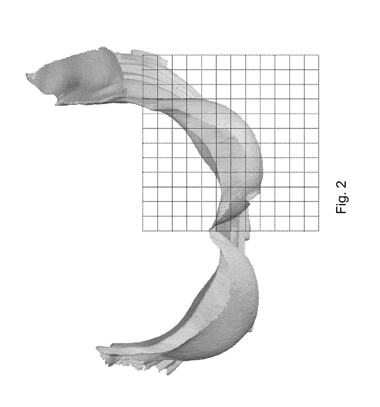 3d-printed unibody mesh structures for breast prosthesis and methods of making same