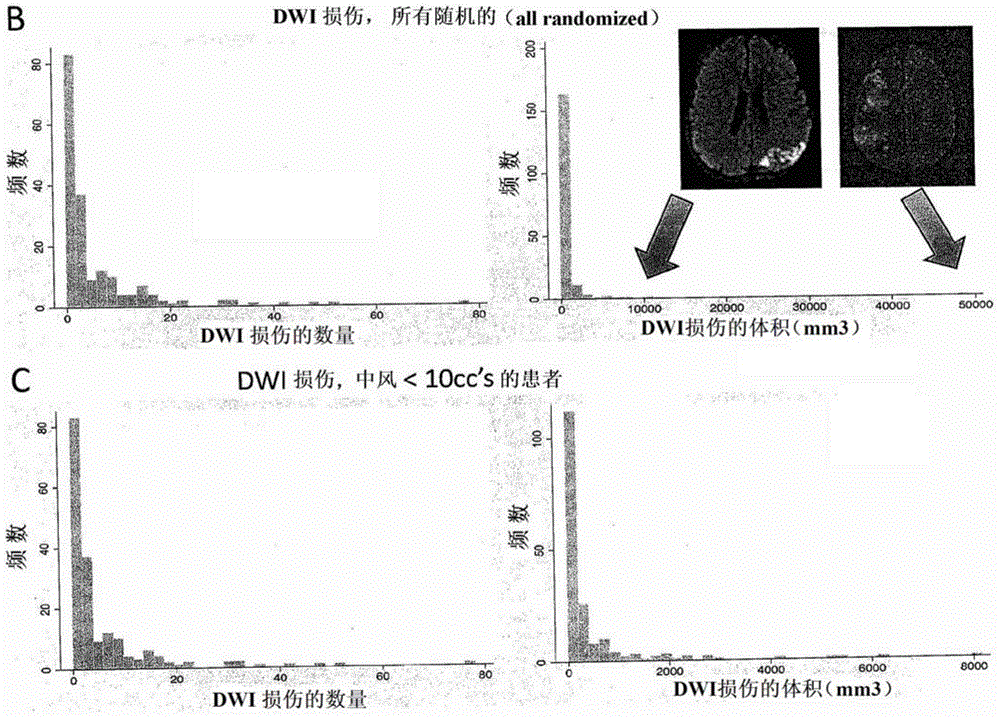 A treatment method for subarachnoid hemorrhage and local ischemia