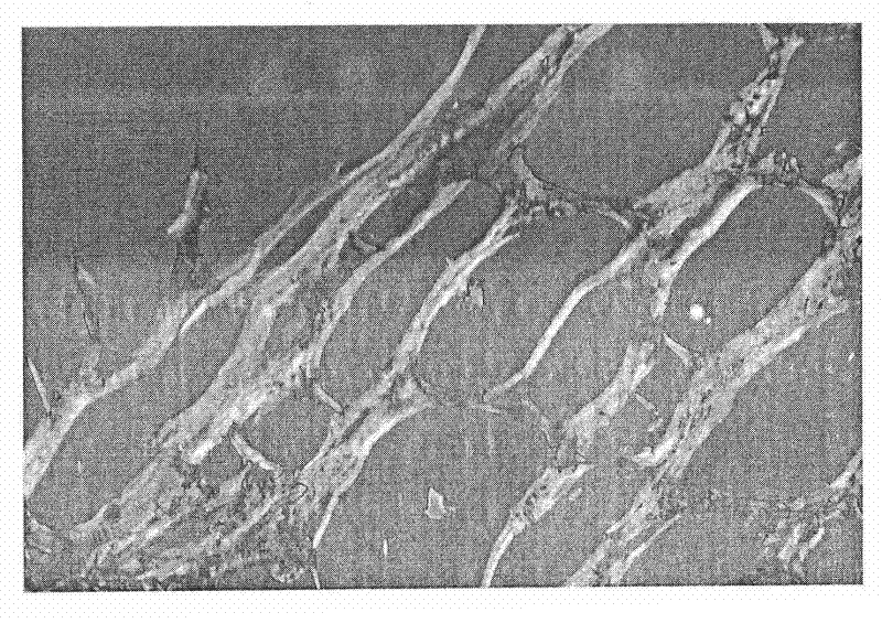 Method for preparing medical III type collagen