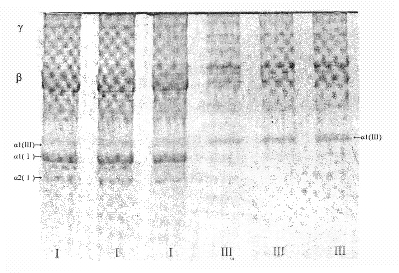 Method for preparing medical III type collagen