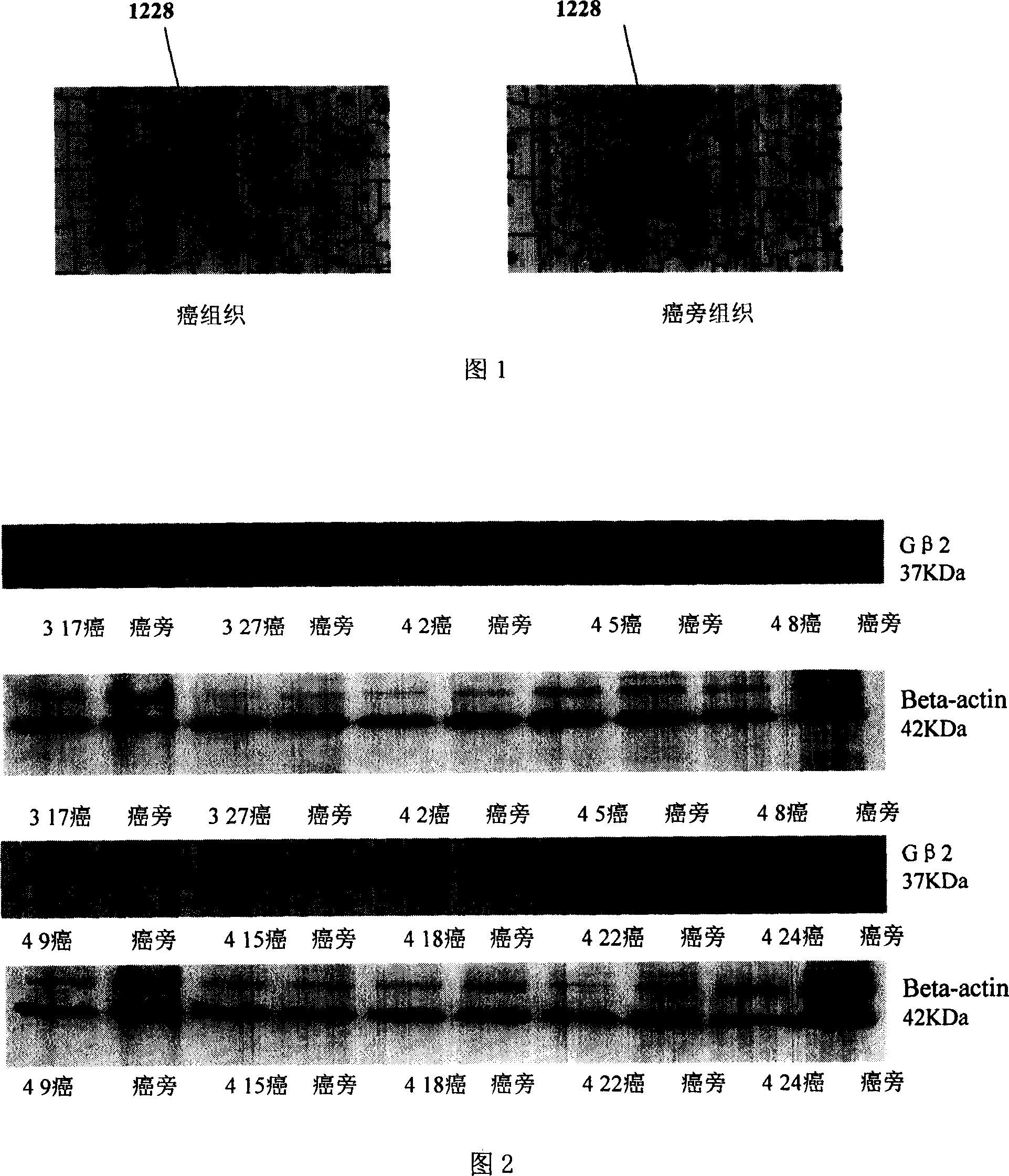 Application of G Protein beta subunit