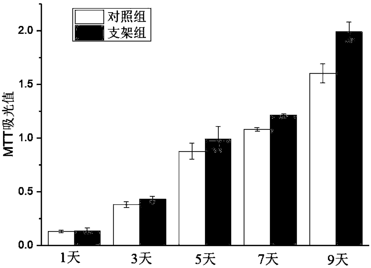 Biological three-dimensional printing preparation method of chondrocyte loading anti-inflammatory meniscus bracket