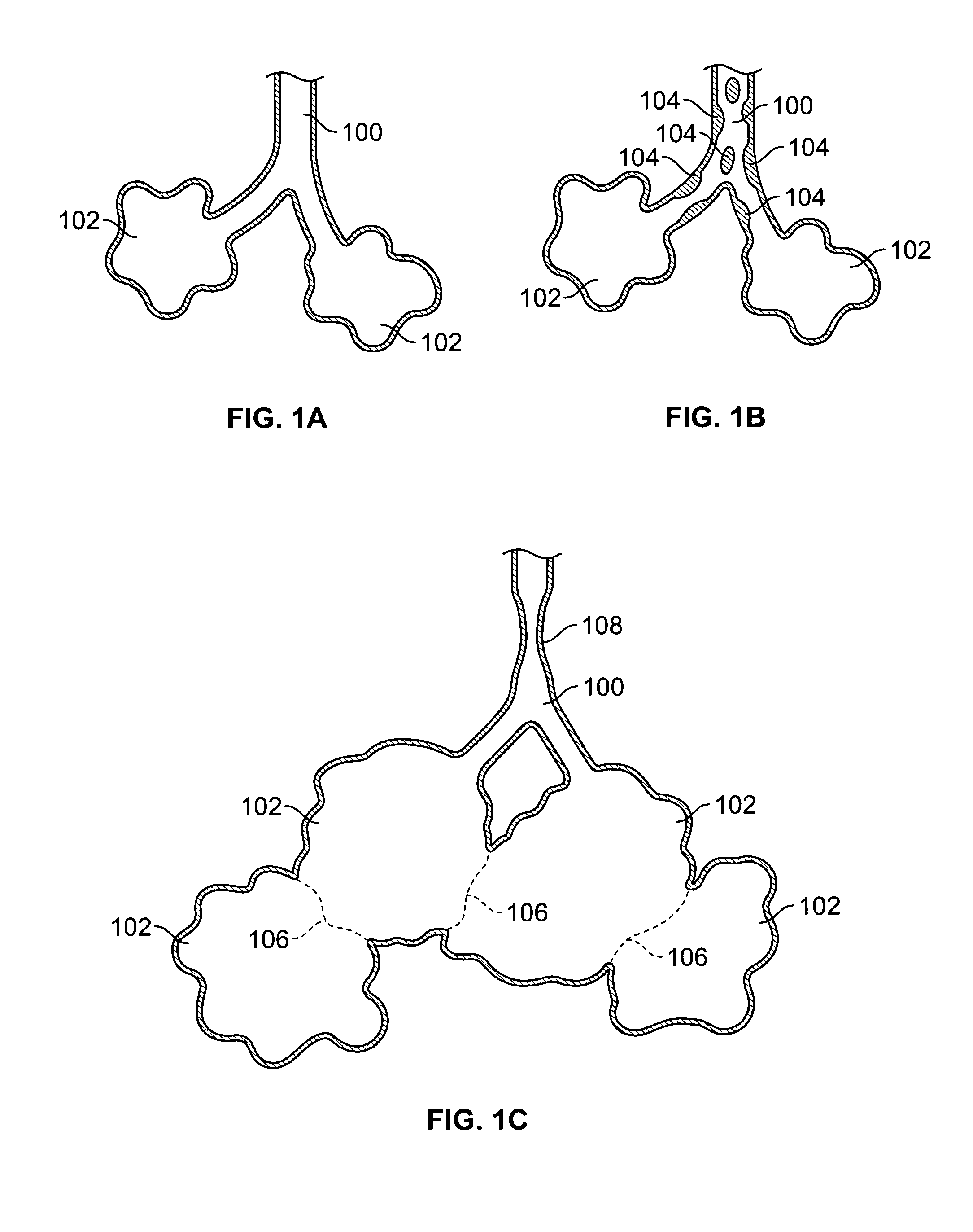 Methods and devices for maintaining surgically created channels in a body organ