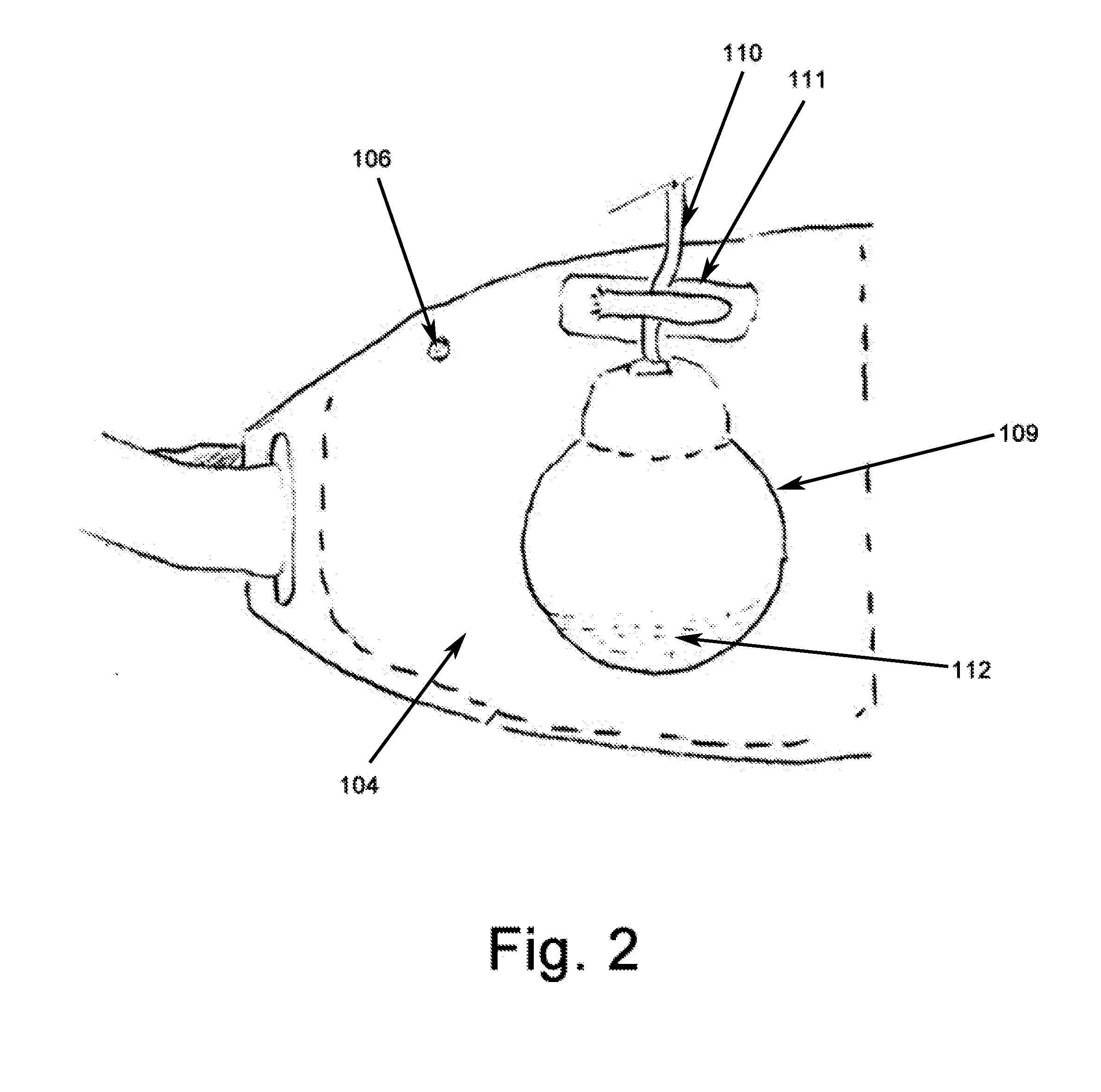 Carry Belt for Vacuum Surgical Drains