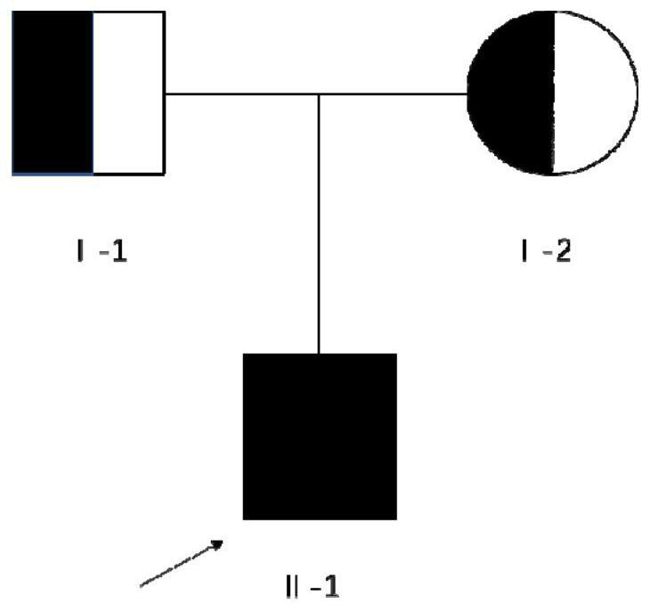 MYO15A gene mutant and application thereof