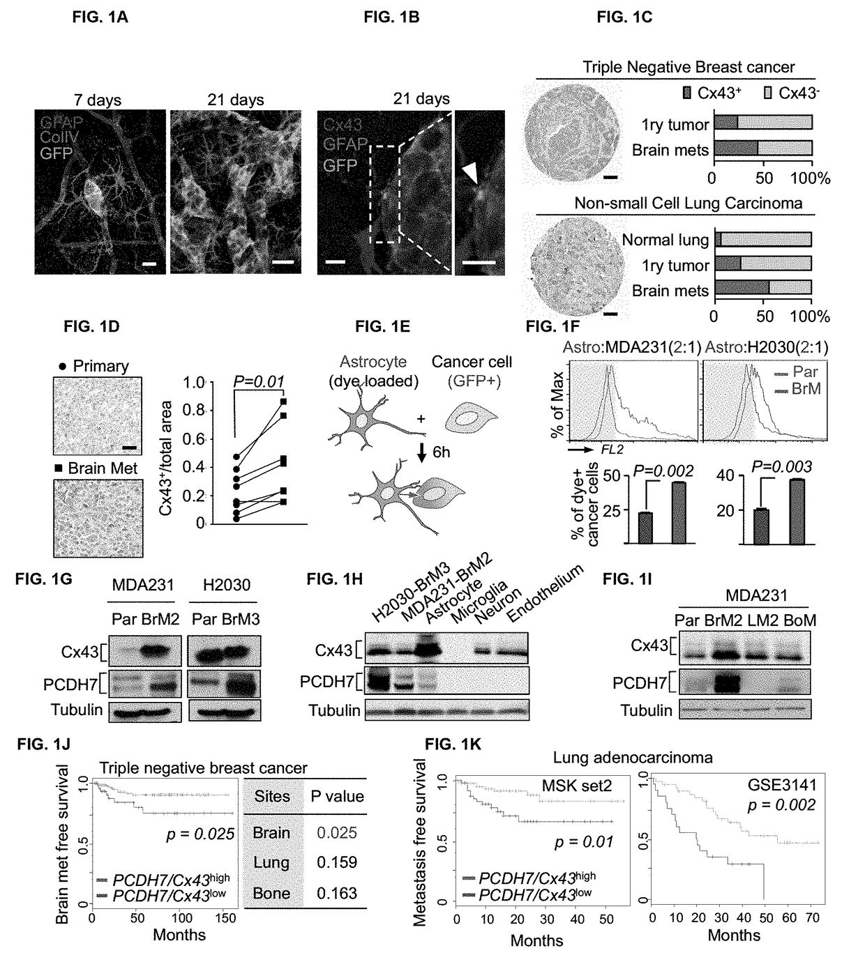 Methods for treating brain metastasis