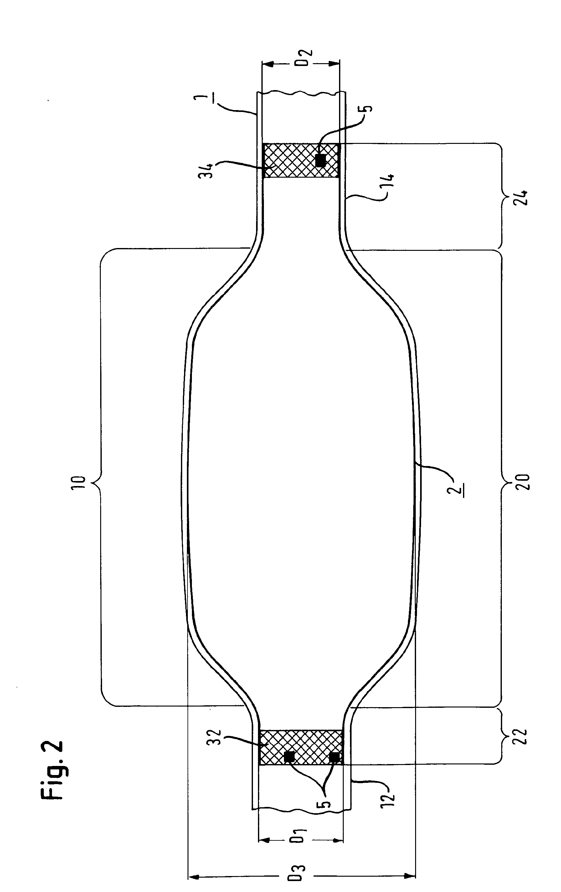 Vascular Prosthesis for Aneurysms, Set of Vascular Prostheses, Method for Manufacturing a Vascular Prosthesis and Method for Inserting a Vascular Prosthesis