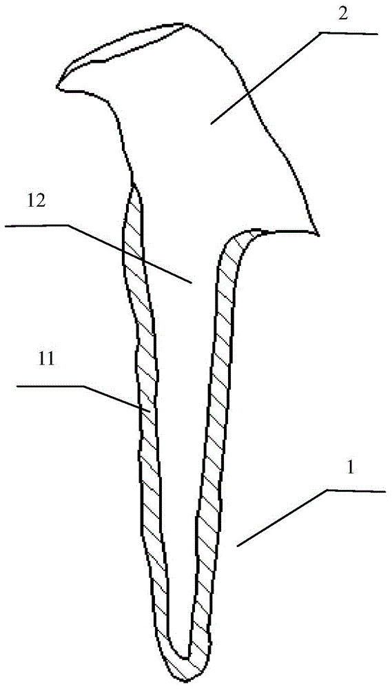 Personalized metallic dental pile simulating mechanical property of natural tooth and manufacturing method thereof