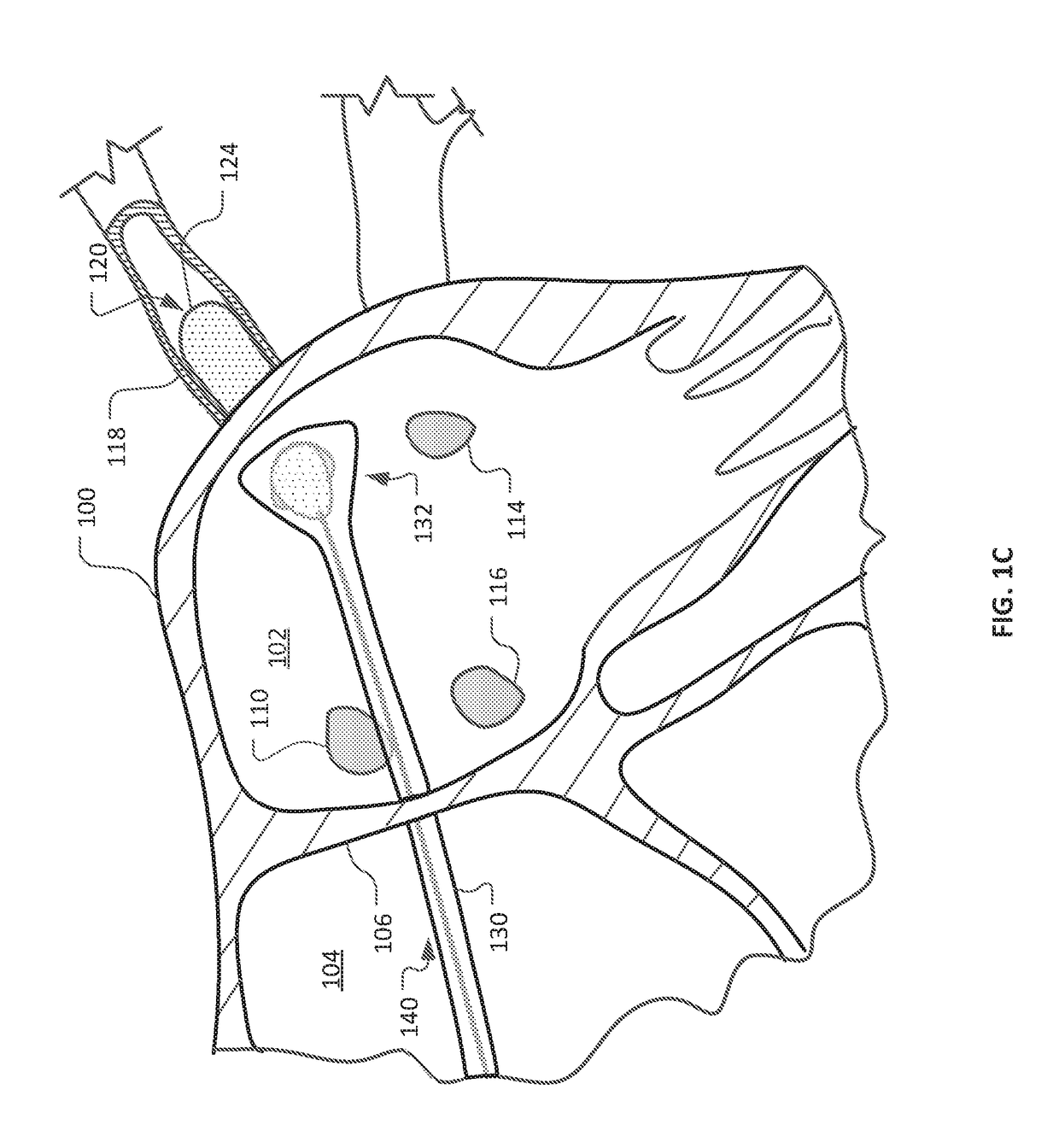 Devices and methods for ablation of tissue