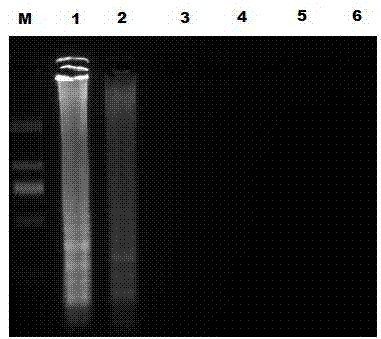 Loop-mediated isothermal amplification reaction primer for detecting porcine parvovirus II