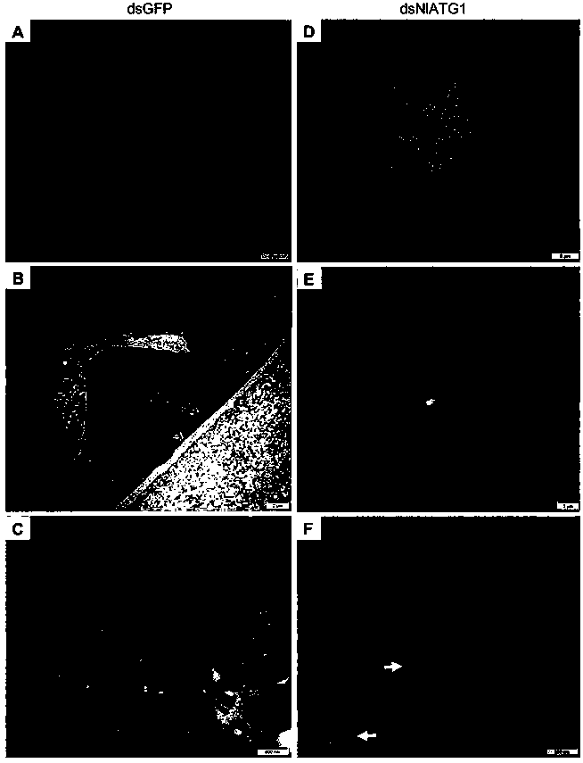 Brown planthopper NlAtg1 gene and application thereof and encoded protein and application thereof