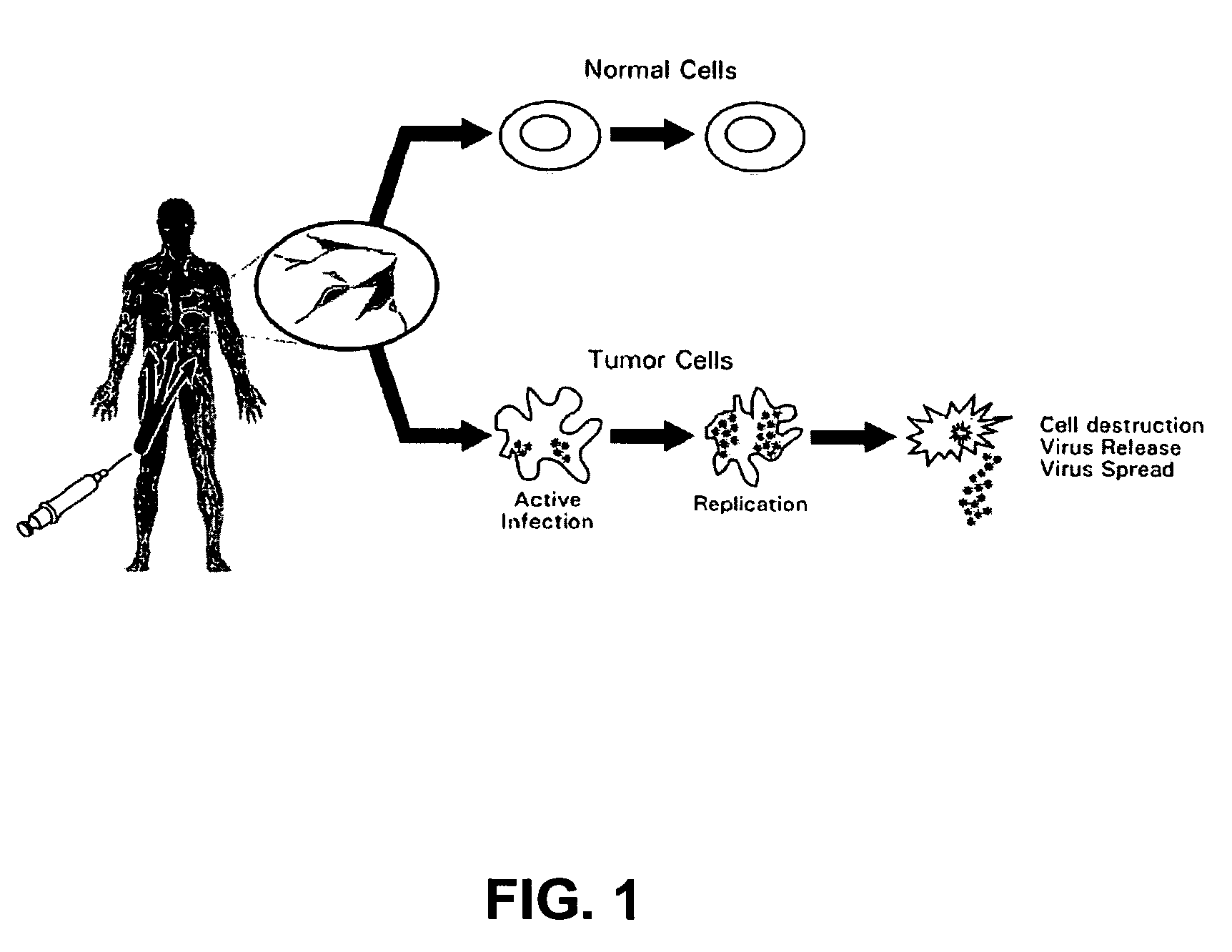 Seneca Valley virus based compositions and methods for treating disease