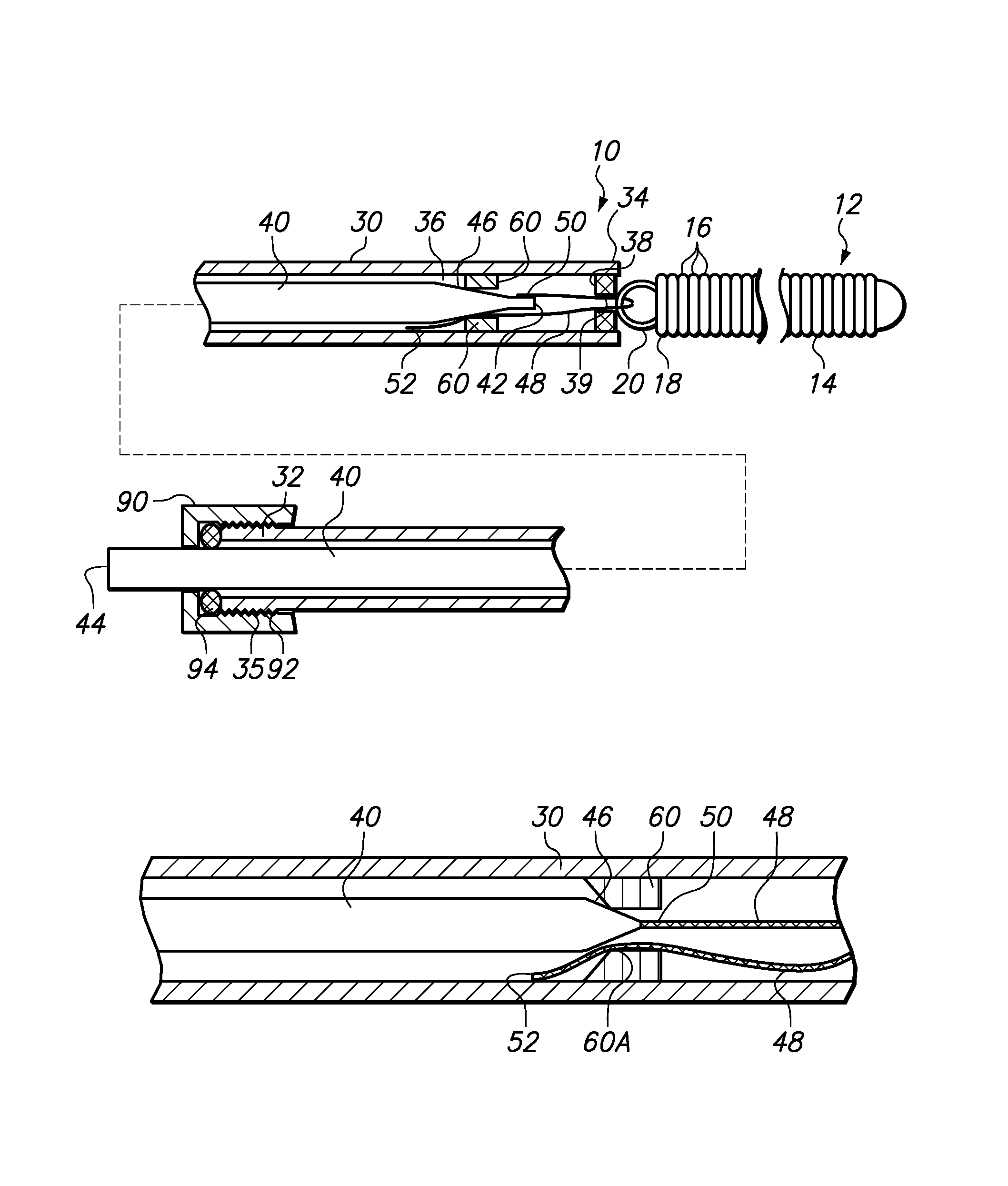 Mechanically detachable vaso-occlusive device