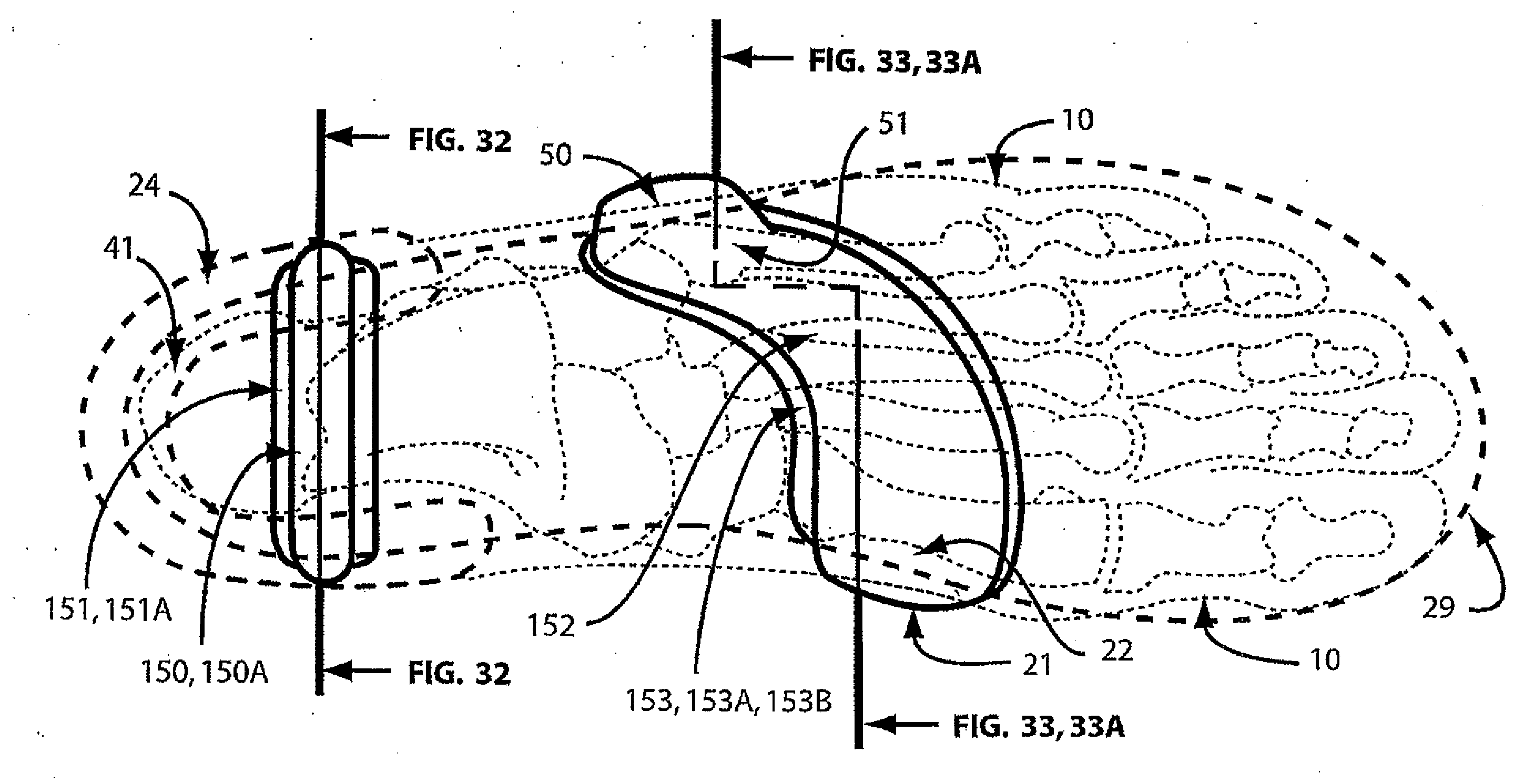 Footwear support structures