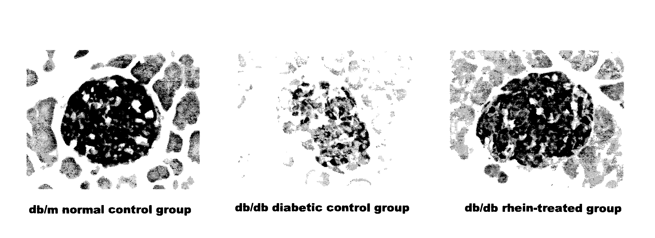 Method of a rhein compound for inhibiting pancreatic islet beta-cell dysfunction and preventing or treating a pancreatic islet beta-cell dysfunction related disorder