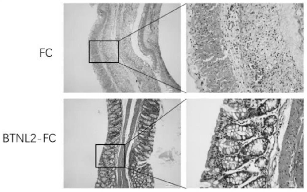 BTNL2 recombinant protein, preparation method thereof and application of BTNL2 recombinant protein in preparation of medicine for treating inflammatory bowel disease