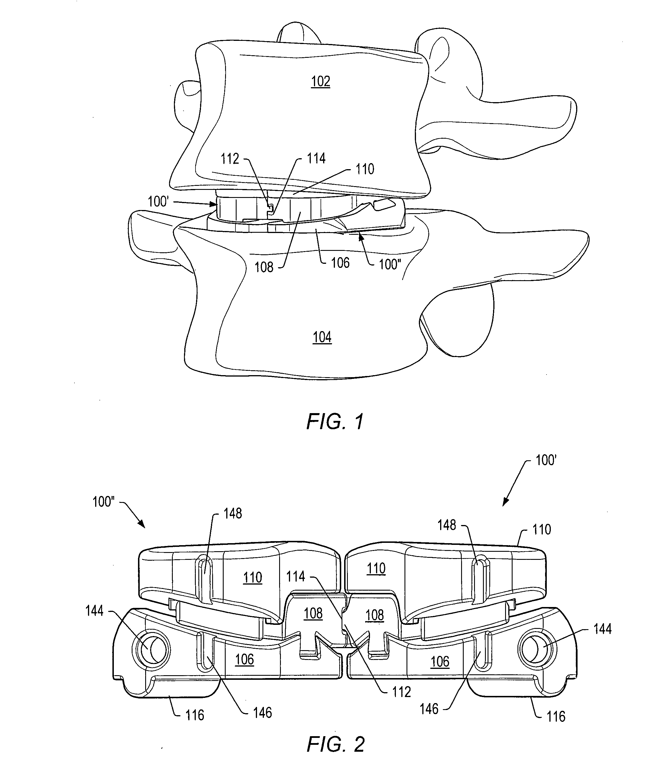 Dampener system for a posterior stabilization system with a fixed length elongated member