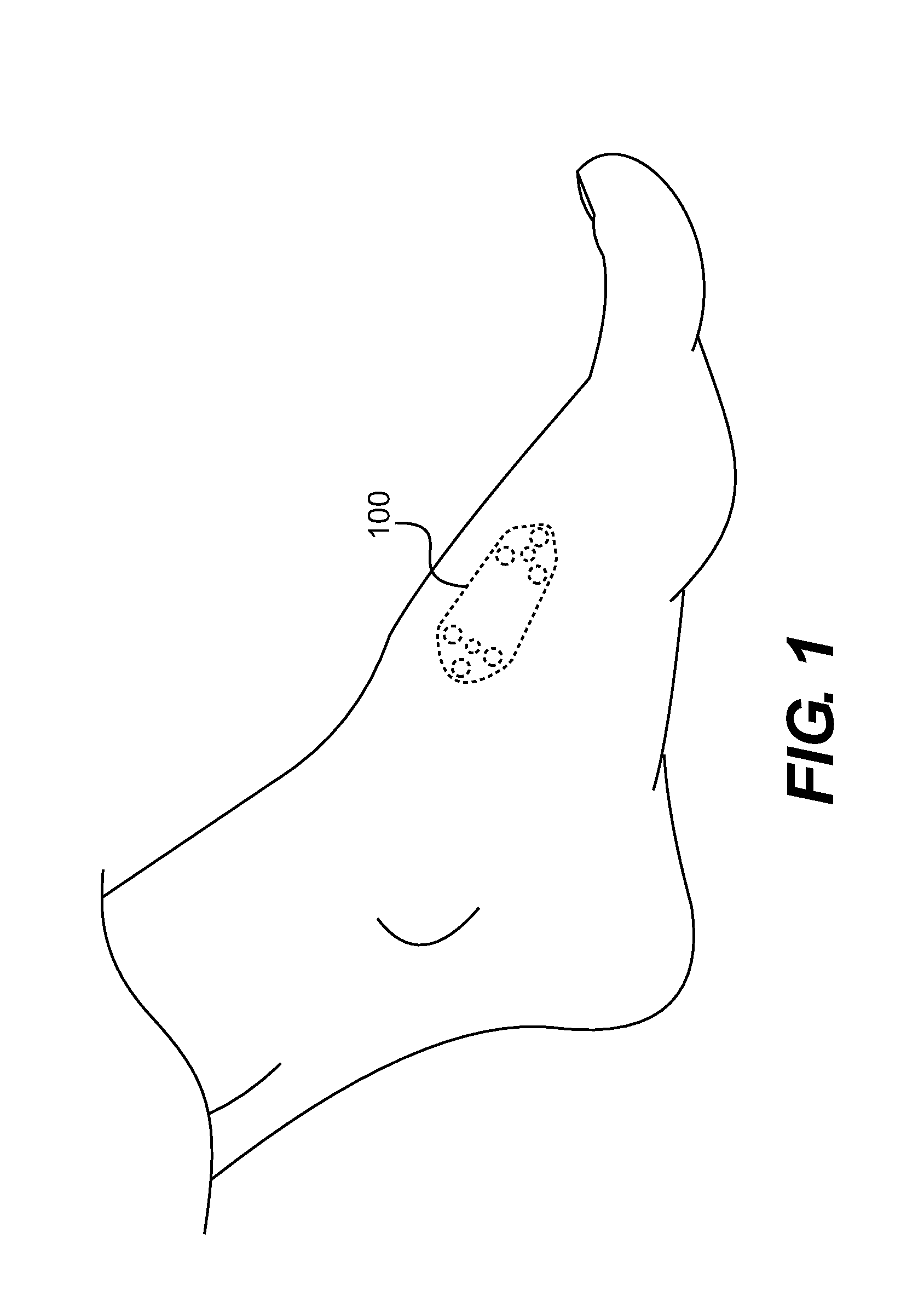 Implant for correcting skeletal mechanics