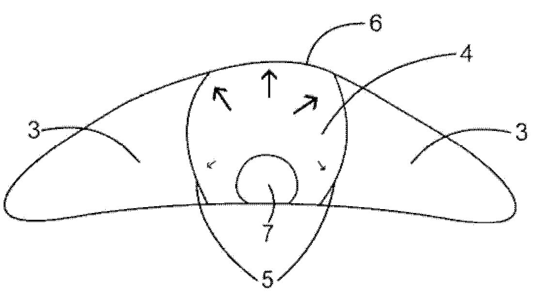 Silicon implant with expandable and/or interactive compartments, optionally coated with a ricinus communis and/or hydroxylapatite polyurethane foam, with attachment flaps or strings