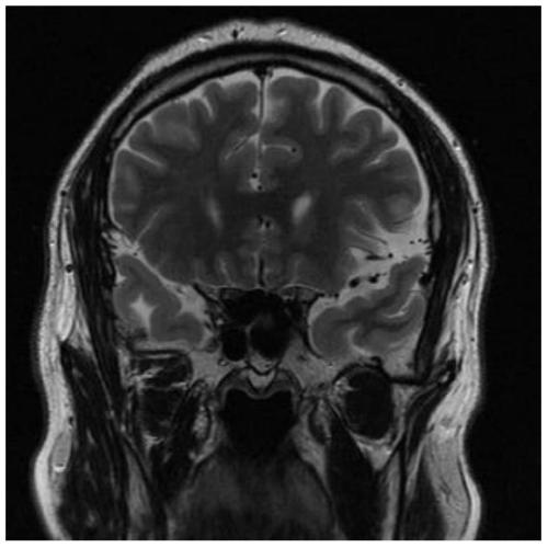 A medical image processing method and system