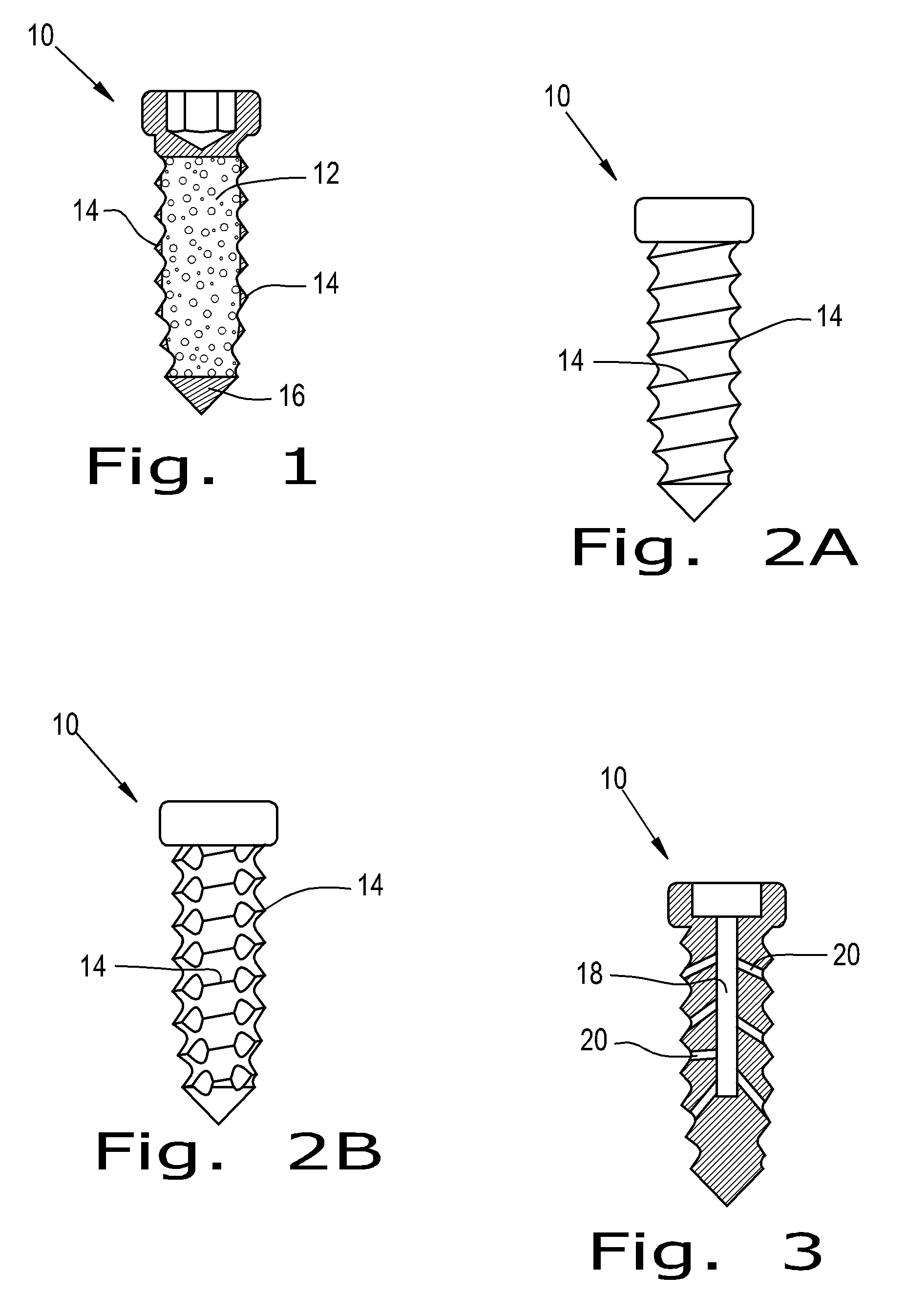 Orthopaedic screws