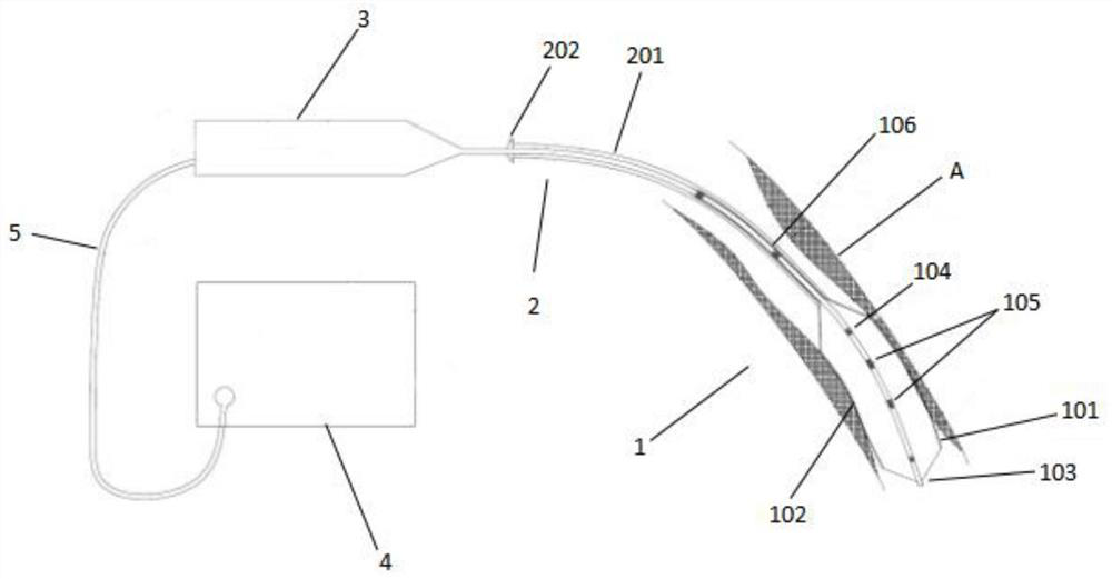 Multifunctional balloon catheter system for cardiovascular stenosis