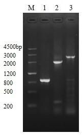 Construction and application of PhoPR gene overexpressed BCG strain