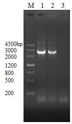 Construction and application of PhoPR gene overexpressed BCG strain