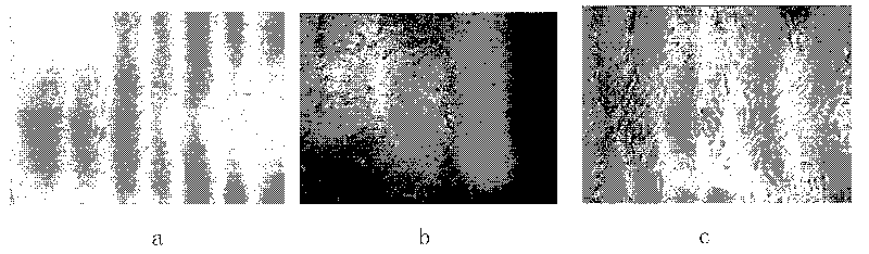 Method for amplifying autologous bone marrow mesenchymal stem cells