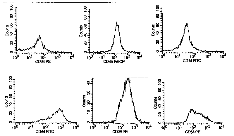 Method for amplifying autologous bone marrow mesenchymal stem cells