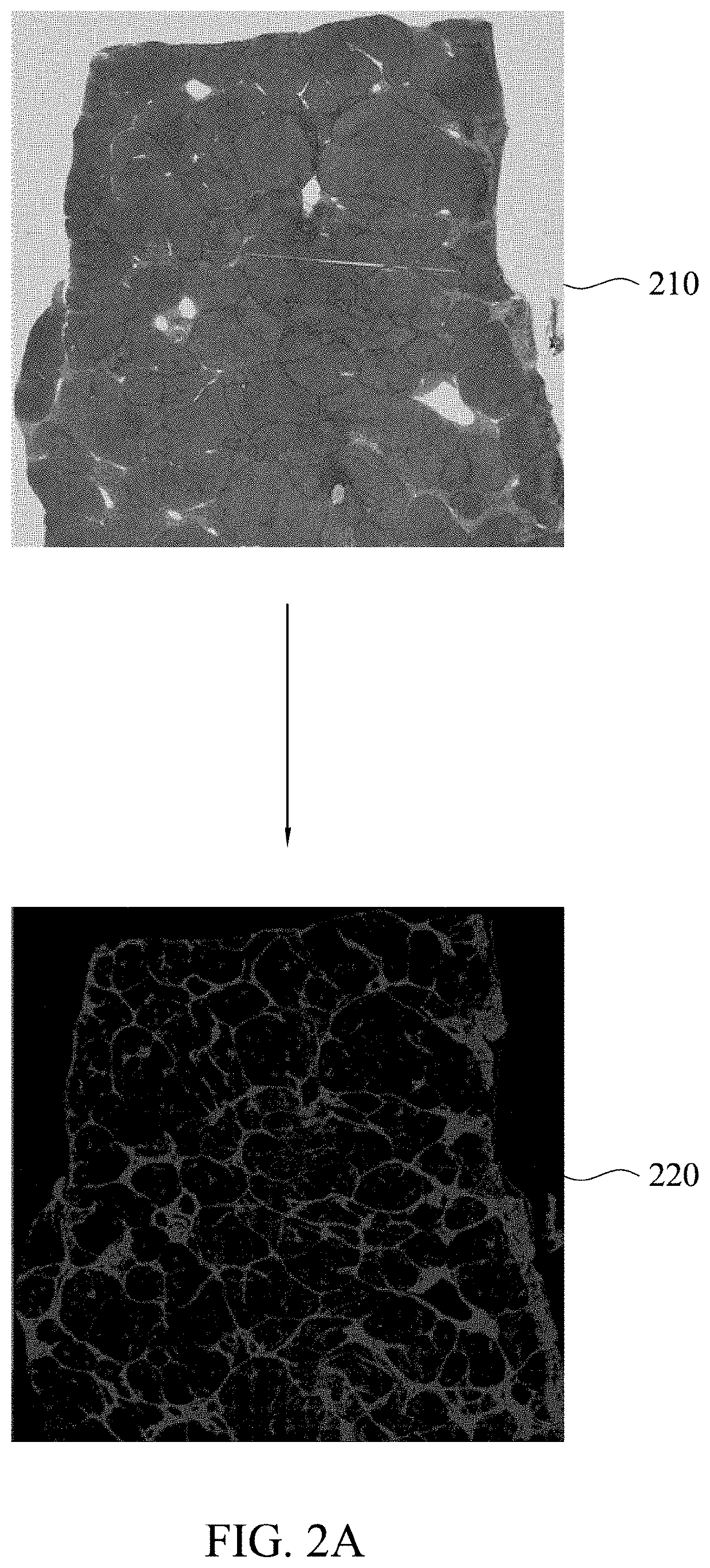 Computer aided method and electrical device for analyzing fibrosis