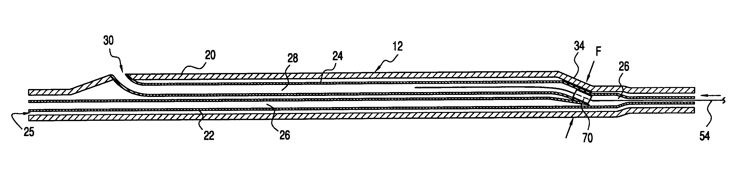 Catheter having auxiliary lumen