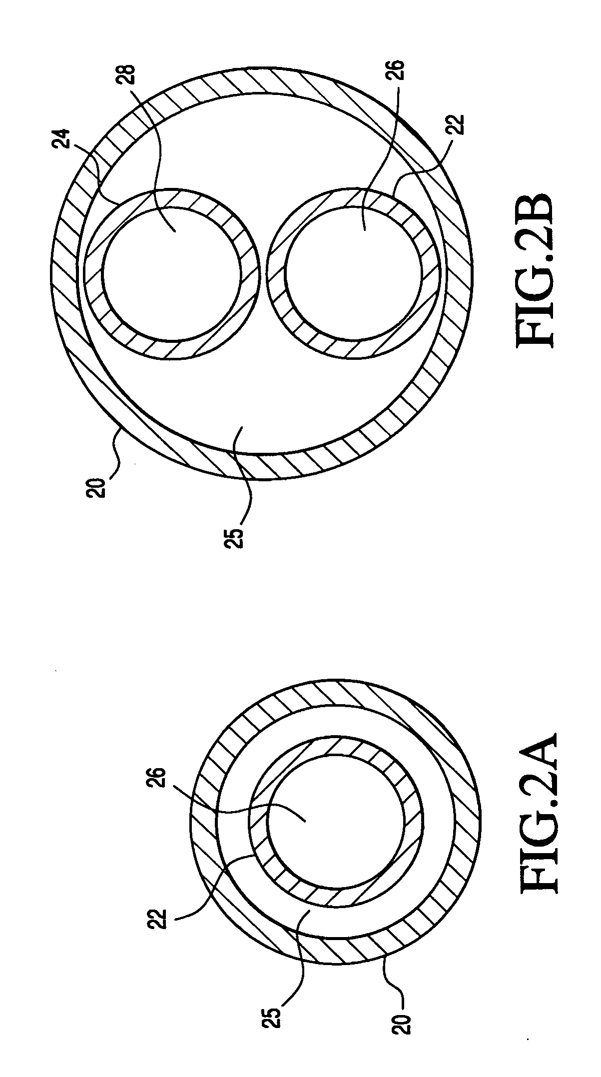 Catheter having auxiliary lumen