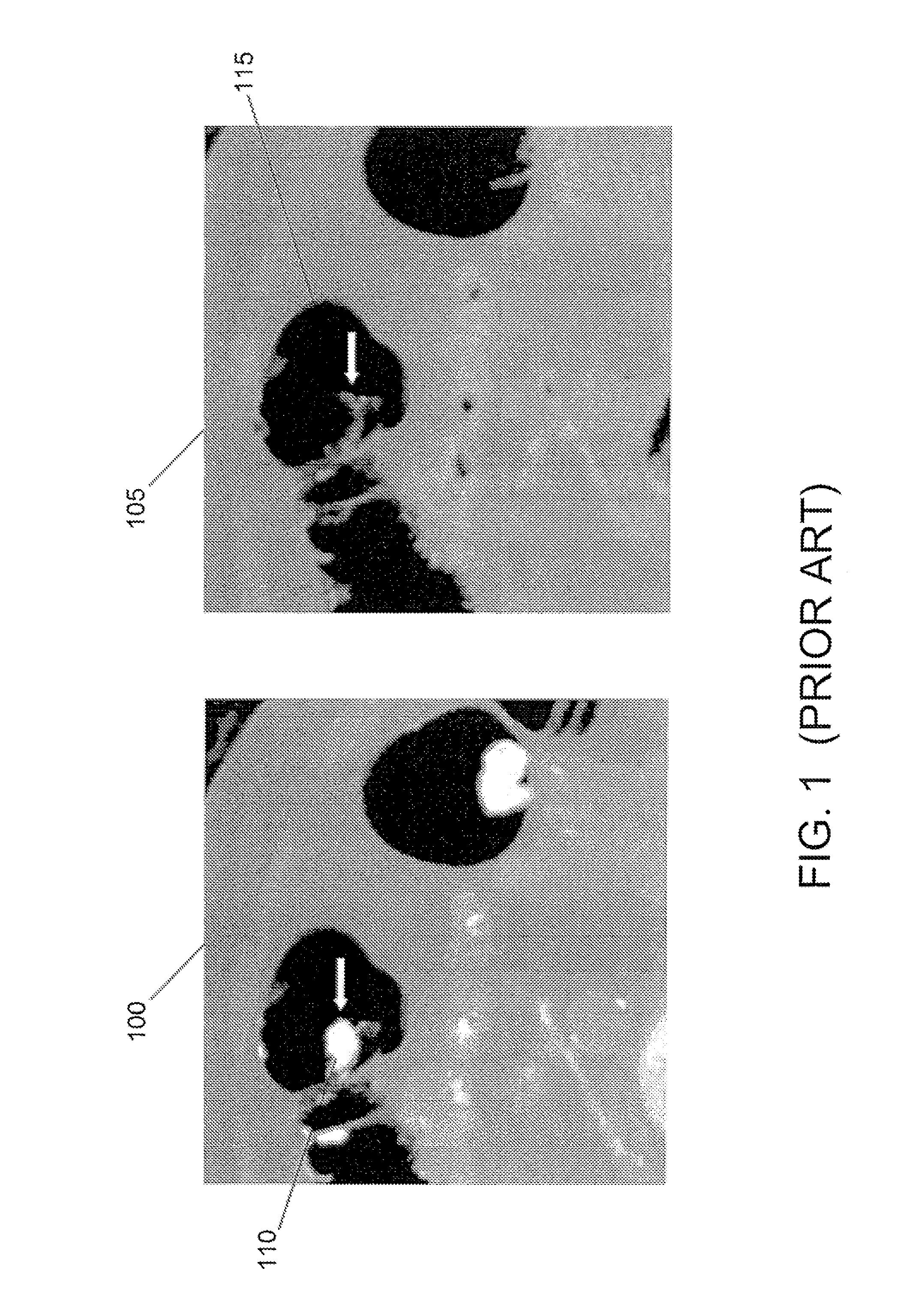 Structure-analysis system, method, software arrangement and computer-accessible medium for digital cleansing of computed tomography colonography images