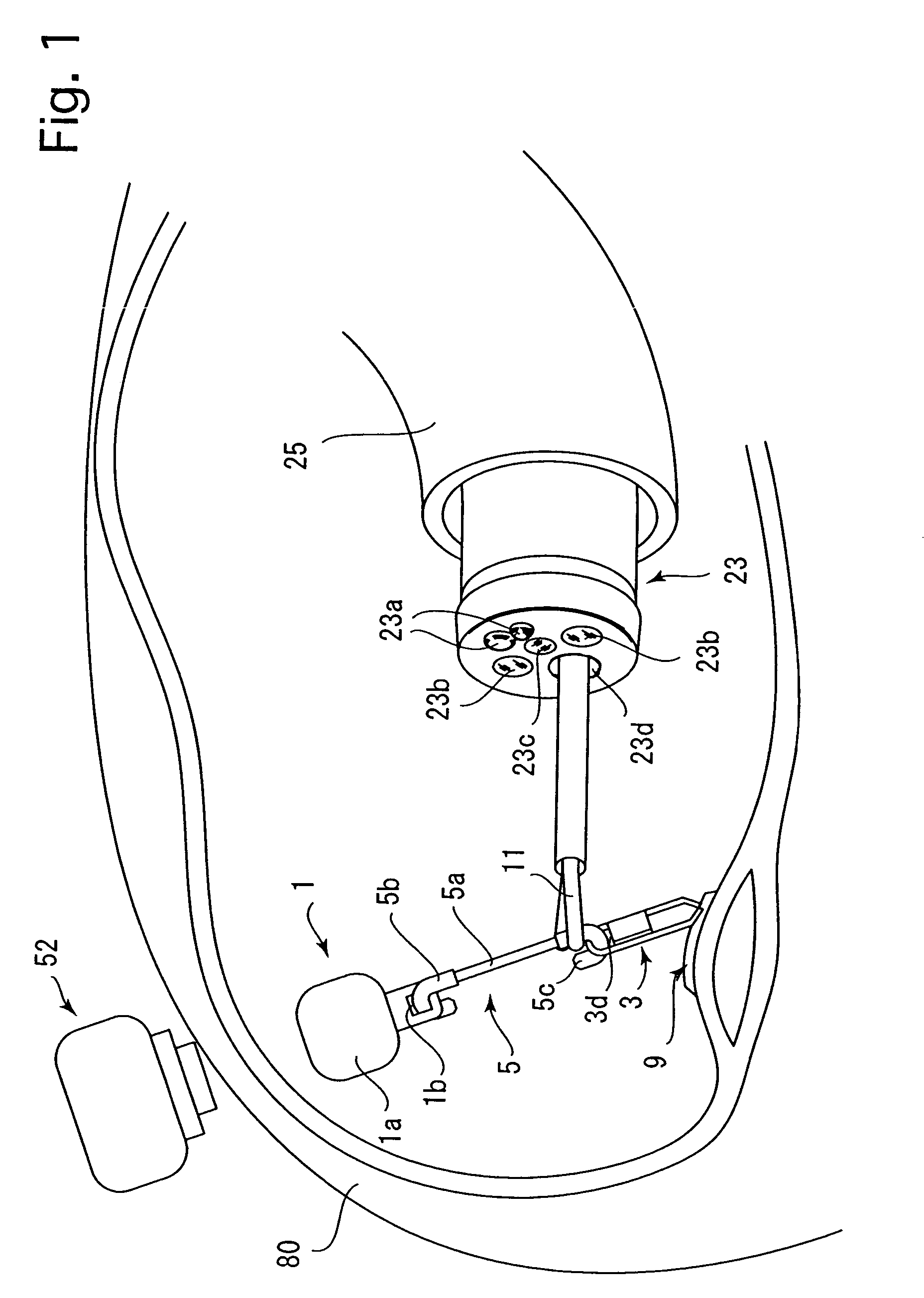 Magnetic anchor remote guidance system