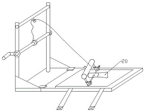 Phalanx retractor