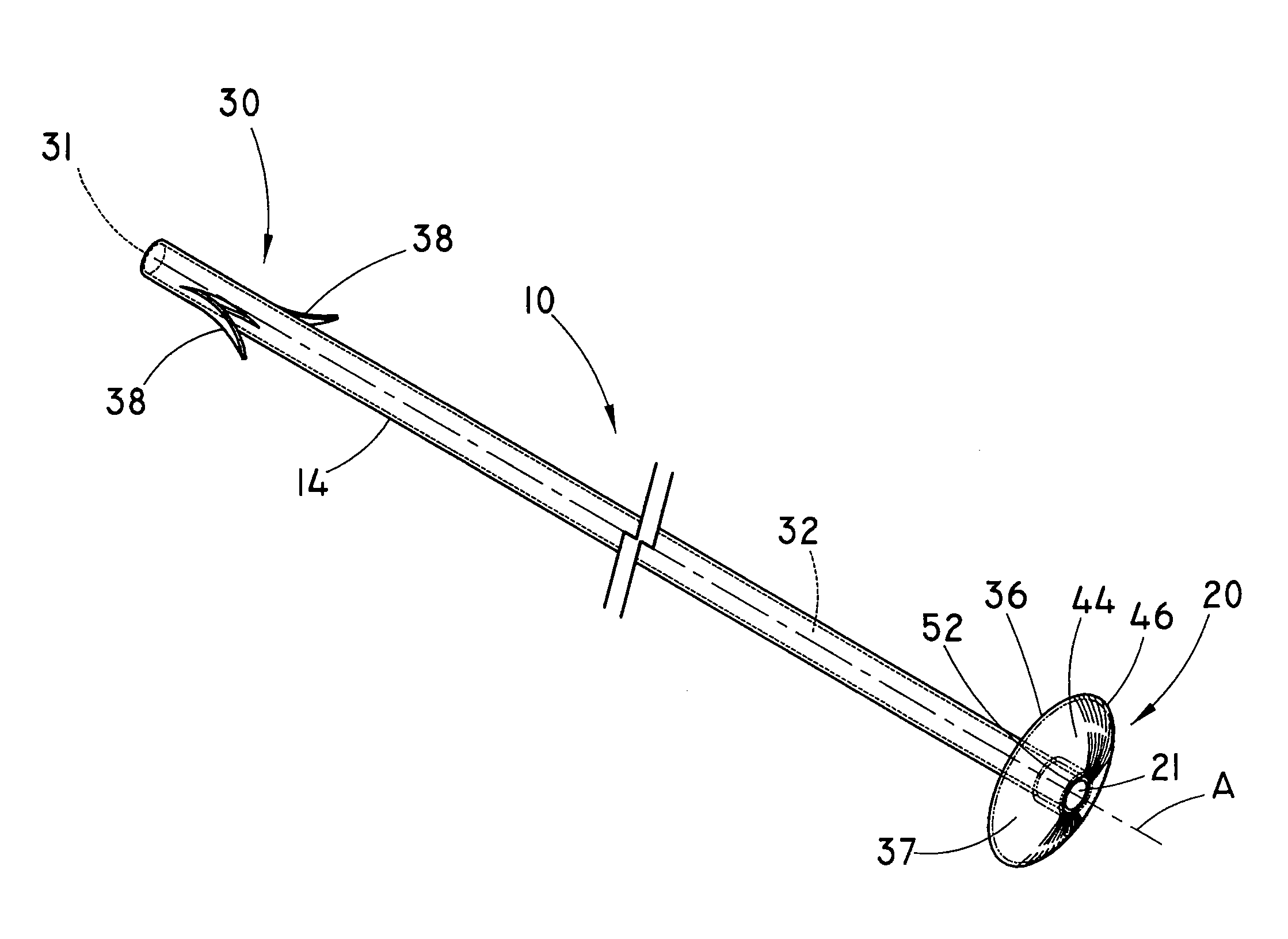 Prophylactic Pancreatic Stent